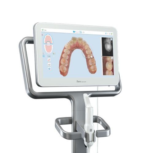 iTero® Scanner | Darya G. Ghafourpour | Dentist, San Rafael, CA